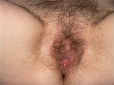 Pinterest Hairy Woman on 10445