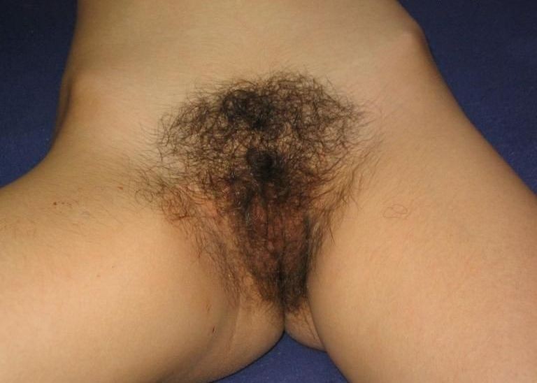 Pinterest Hairy Woman on 12284