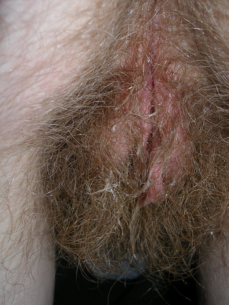 Pinterest Hairy Woman on 5835