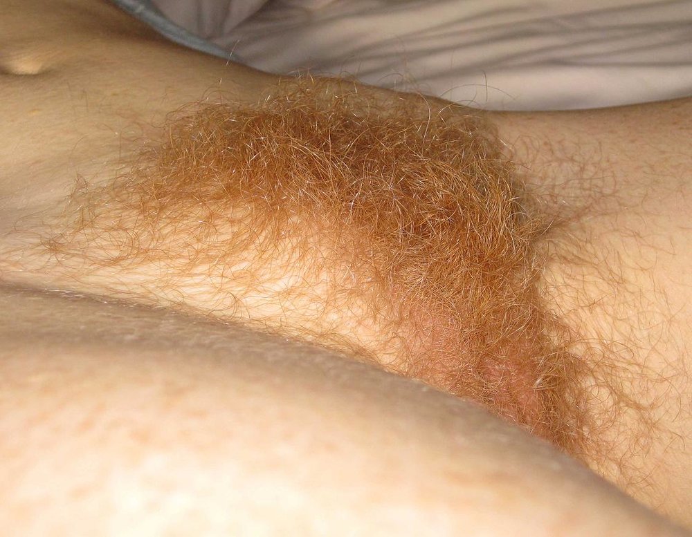 Pinterest Hairy Woman on 1419