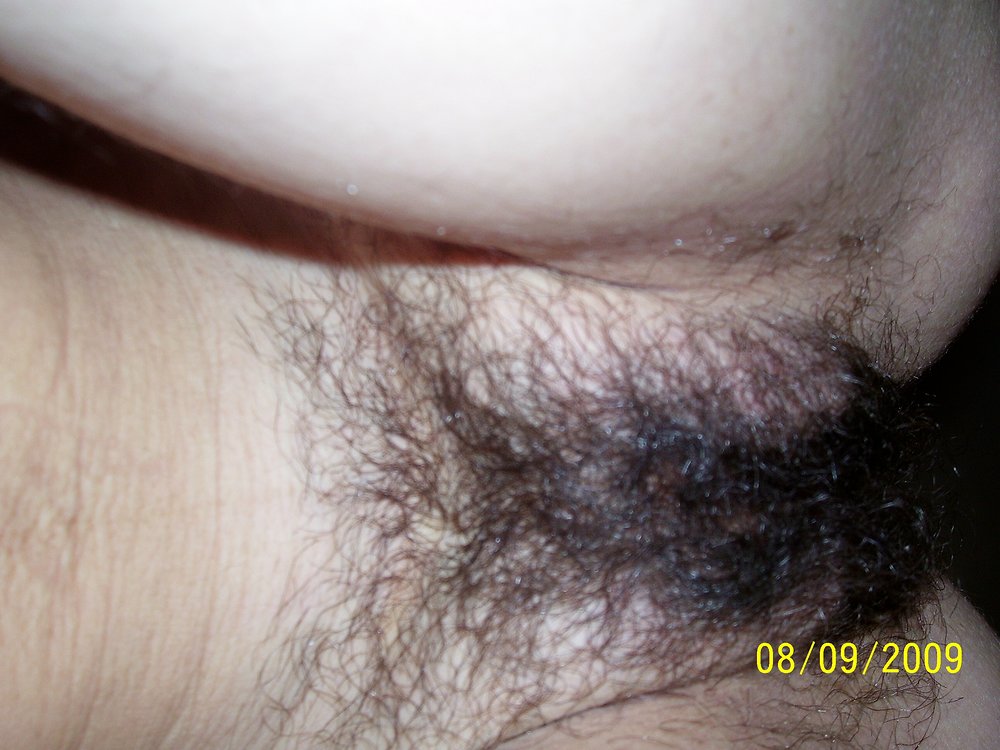 Pinterest Hairy Woman on 9491