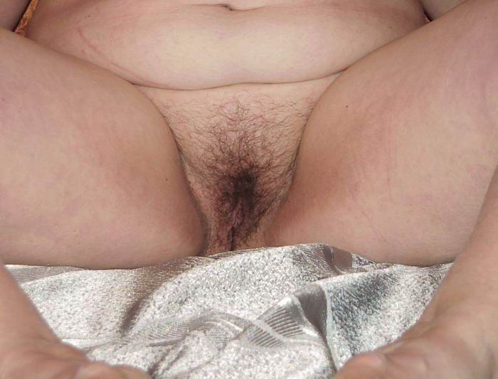 Pinterest Hairy Woman on 9182