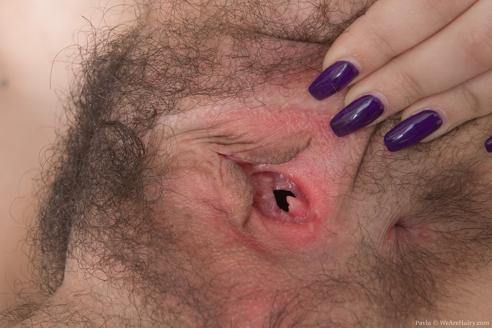 Pinterest Hairy Woman on 11880